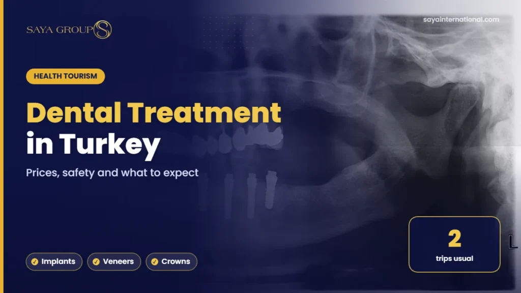 Dental Treatment in Turkey – Prices, safety and what to expect